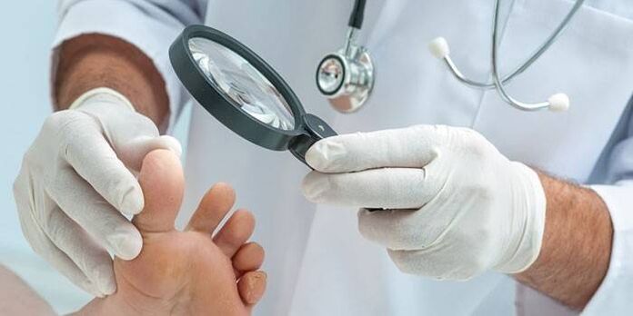 Ārsts ar palielināmo stiklu apskata pacienta pēdu ar smaili