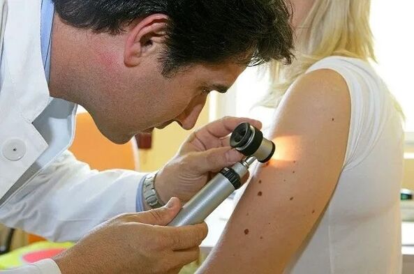 papilomu diagnostika